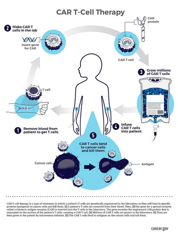 Diagram of CAR T-cell therapy showing cells removed from a patient, engineered in the laboratory, multiplied and returned