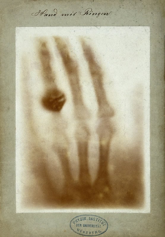 Röntgen's X-ray of a hand, the bones showing dark against a sepia ground with a ring visible on one finger, handwritten "Hand mit Ringen" at the top
